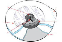 ECG Electrodes