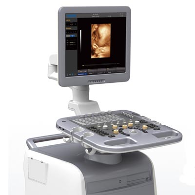 Chison Ultrasound i3