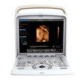 Chison Ultrasound Q5