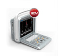 Chison Ultrasound Q9
