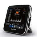 Chison Ultrasound SonoTouch 30