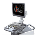 Chison Ultrasound i7