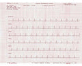Bionet ECG-PP ECG paper