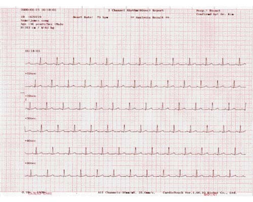 Bionet ECG-PP ECG paper