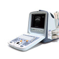 Chison 9300 Ultrasound System