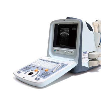 Chison 9300 Ultrasound System