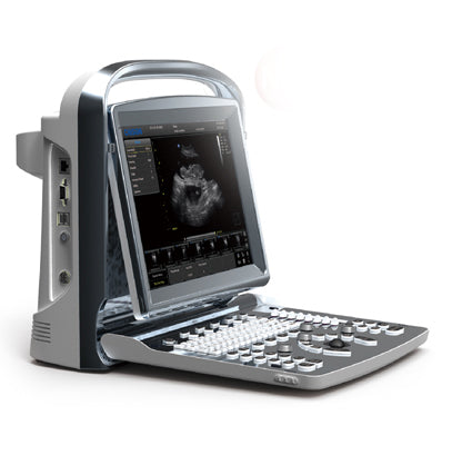 Chison ECO1Vet Ultrasound System