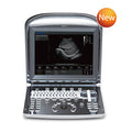Chison ECO1 Ultrasound System
