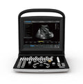 Chison ECO3 Ultrasound System