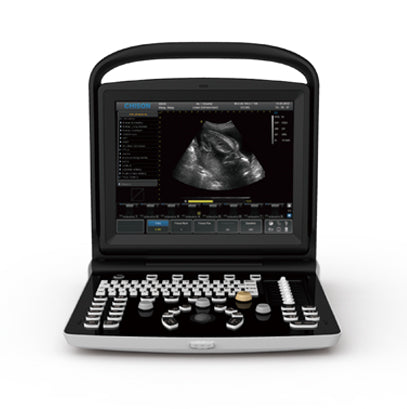 Chison ECO3 Ultrasound System
