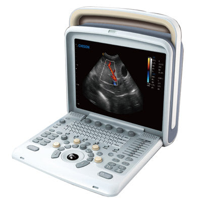 Chison Q5Vet Ultrasound System