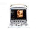 Chison Q5 Color Doppler Ultrasound System