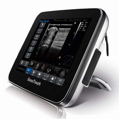 Chison SonoTouch 10 Vet Ultrasound System