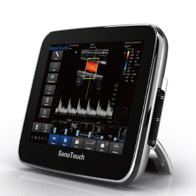 Chison SonoTouch 30 Ultrasound System
