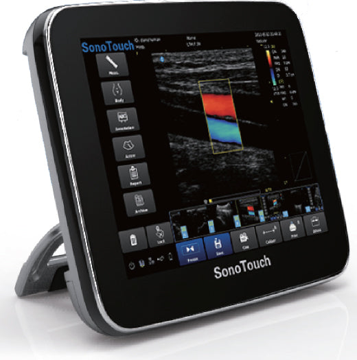Chison SonoTouch V-Access Ultrasound System