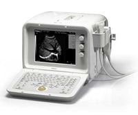 Edan D3 Ultrasound