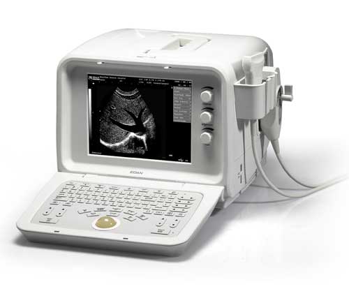 Edan D3 Ultrasound