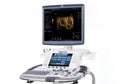GE Logiq E9 Ultrasound