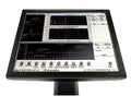 GE MARS Ambulatory ECG system