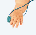 SpO2 Infant Sensor Reusable Philips infant reusable glove sensor