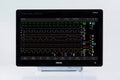 Philips MX850 Intellivue Monitor