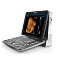 Mindray Z60 Diagnostic Ultrasound