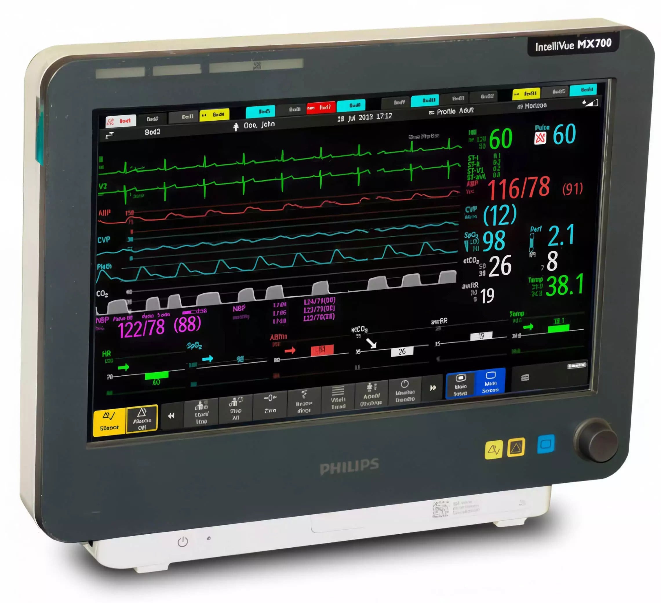 Philips MX750 Patient Monitor