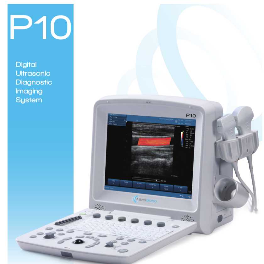 MediSono P10 Digital Ultrasonic Diagnostic Imaging System