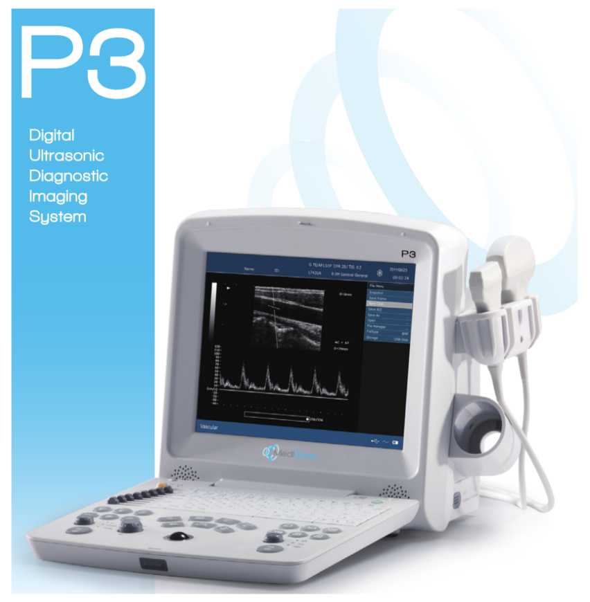 MediSono P3 Ultrasound System