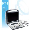 MediSono P11 Digital Ultrasonic Diagnostic Imaging System