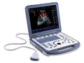 Mindray M5 Doppler Ultrasound