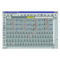 Philips Holter Monitoring Software