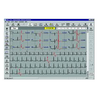 Philips Holter Monitoring Software