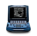 SonoSite Micromaxx Ultrasound Machine