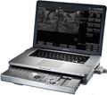 Terason t3000 Ultrasound
