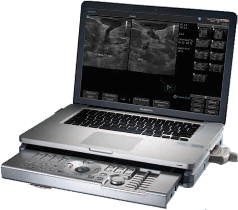 Terason t3200 Ultrasound