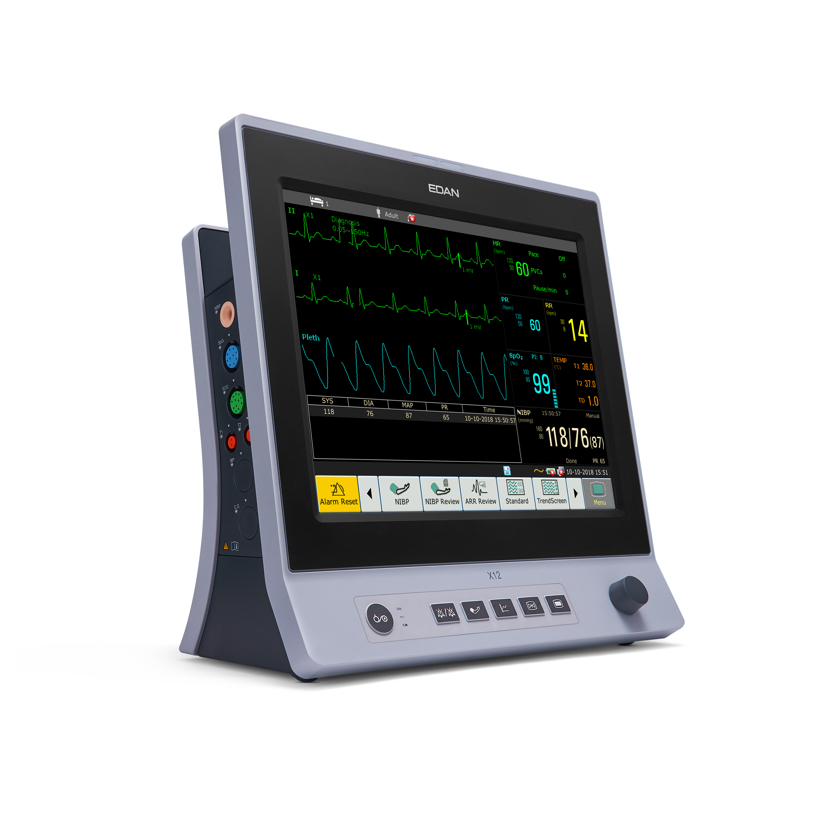 Edan X12 Patient Monitor