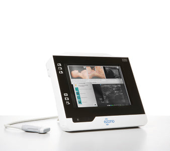 Ambu eZono 3000 - Ultrasound System