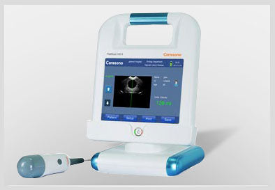Caresono HD5 Bladder Scanner
