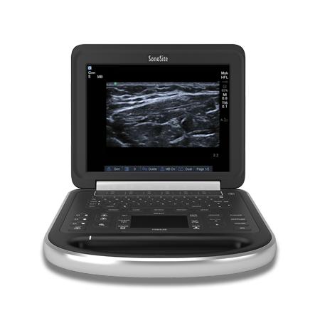 Sonosite Edge Ultrasound Machine
