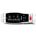 Masimo Radical 7 Pulse Oximeter