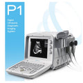 MediSono P1 Digital Ultrasonic Diagnostic Imaging System