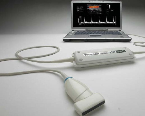 Terason T2000 Ultrasound (Laptop/PC not included)