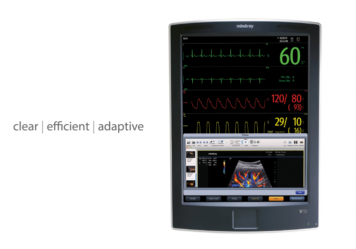 Mindray Patient Monitor V21